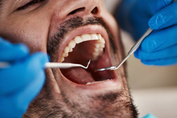 Best Broken or Cracked Tooth Emergency Dentist in San Diego, TX