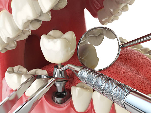 Best Emergency Dental Extractions in San Diego, TX